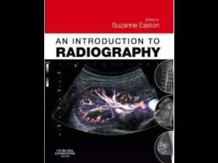 An Introduction to Radiography by Suzanne Easton