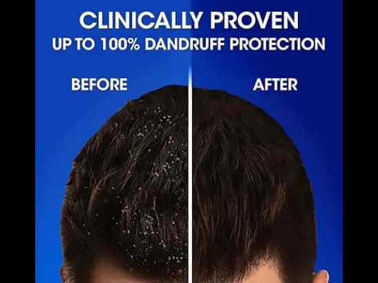 Head & Shoulders Anti Dandruff Cool Menthol Shampoo - 340ml (6)