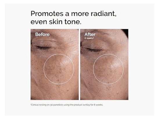 The Ordinary Glycolic Acid 7% Exfoliating Toner Daily AHA Toner to Improve Skin Texture, Tone & Luminosity 240ml (4)