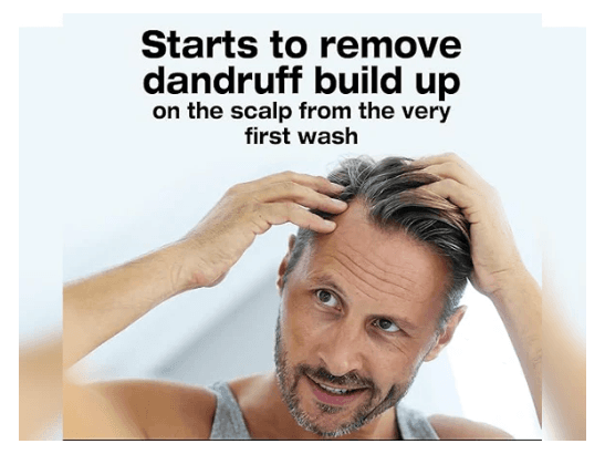 Neutrogena T/Gel Anti-Dandruff Shampoo For Dry Hair 150ml - GREECE (3)