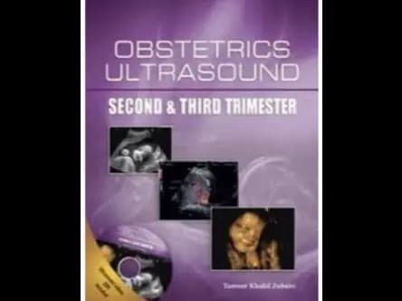 Obstetrics Ultrasound : Second and Third Trimester + Dvd by Tanveer Khalid Zubairi