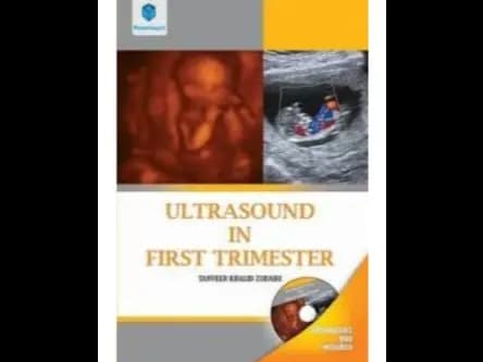 Ultrasound in First Trimester + Cd by Tanveer Khalid Zubairi