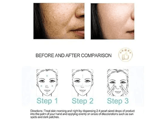 Dr. Rashel Whitening Fade Spots Serum 50ml (4)