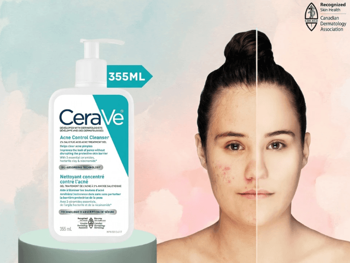 Cerave Acne Control Cleanser 355ml- USA (4)